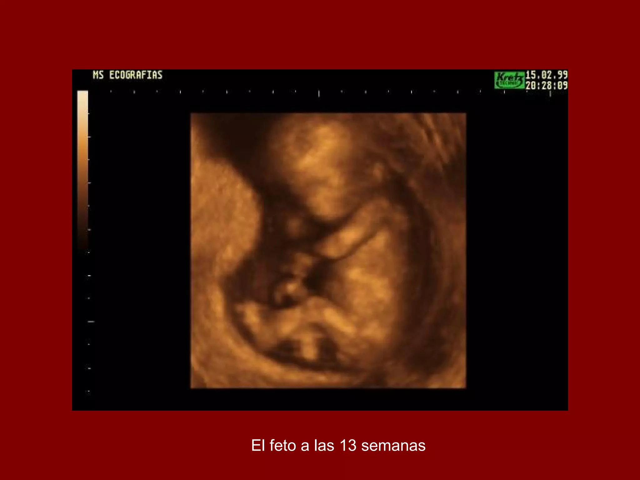 El feto a las 13 semanas