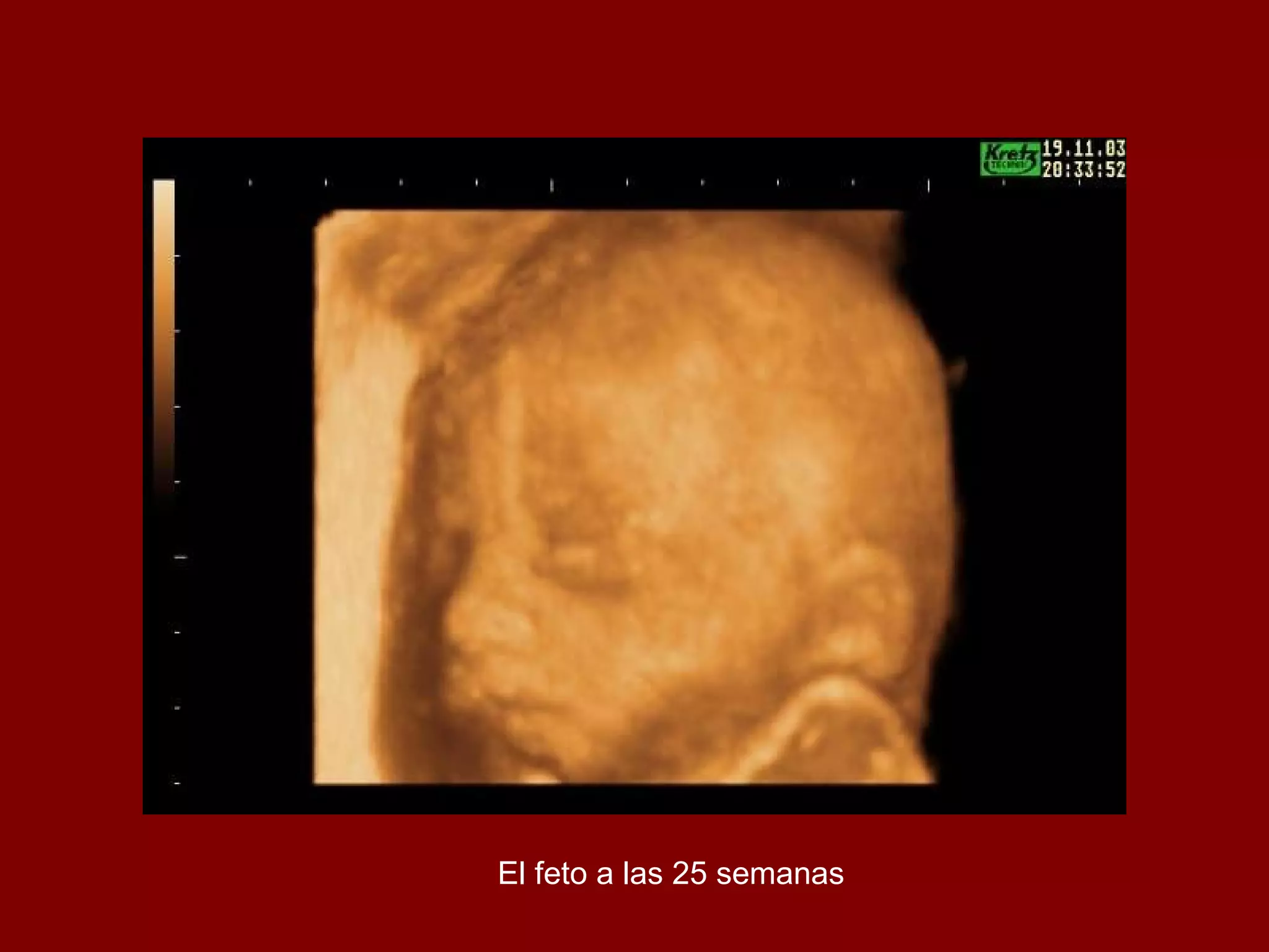 El feto a las 25 semanas