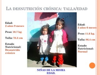Edad:
2 años 9 meses
Peso: 10.7 kg.
Talla: 78.3 cm
Estado
Nutricional:
Desnutrido
crónico
Edad:
2 años 6 meses
Peso: 11.6 kg.
Talla: 86.4 cm
Estado
Nutricional:
Normal
NIÑAS DE LA MISMA
EDAD.
LA DESNUTRICIÓN CRÓNICA: TALLA/EDAD
 