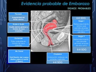4-6 SDG
4-6 SDG
6-8 SDG
Cuello uterino globoso y
fondos de saco
ocupados
Irregularidad del
fondo uterino
 