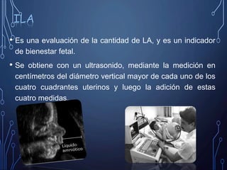 • Es una evaluación de la cantidad de LA, y es un indicador
de bienestar fetal.
• Se obtiene con un ultrasonido, mediante la medición en
centímetros del diámetro vertical mayor de cada uno de los
cuatro cuadrantes uterinos y luego la adición de estas
cuatro medidas.
ILA
 
