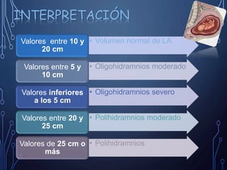 • Volumen normal de LAValores entre 10 y
20 cm
• Oligohidramnios moderadoValores entre 5 y
10 cm
• Oligohidramnios severoValores inferiores
a los 5 cm
• Polihidramnios moderadoValores entre 20 y
25 cm
• PolihidramniosValores de 25 cm o
más
INTERPRETACIÓN
 