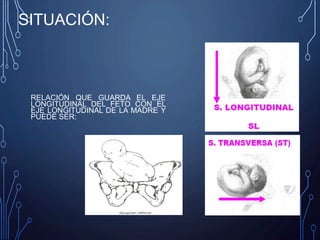 SITUACIÓN:
RELACIÓN QUE GUARDA EL EJE
LONGITUDINAL DEL FETO CON EL
EJE LONGITUDINAL DE LA MADRE Y
PUEDE SER:
 