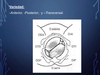 Variedad:
-Anterior, -Posterior, y –Transversal.
 