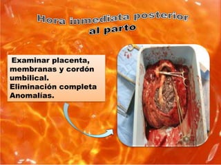 Examinar placenta,
membranas y cordón
umbilical.
Eliminación completa
Anomalías.
 