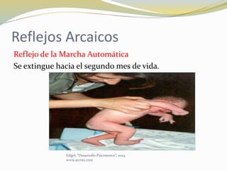 Reflejos Arcaicos
Reflejo de la Marcha Automática
Se extingue hacia el segundo mes de vida.
Edgel, “Desarrollo Psicomotor”, 2014.
www.arcres.com
 