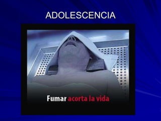 ADOLESCENCIA
 