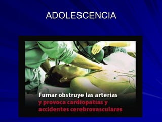 ADOLESCENCIA
 