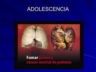 ADOLESCENCIA
 