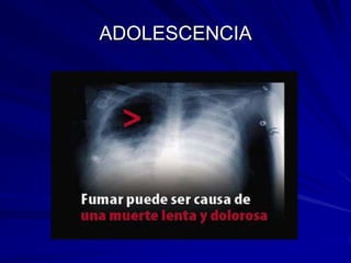 ADOLESCENCIA
 