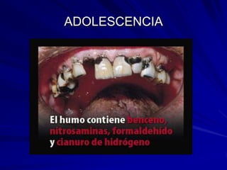 ADOLESCENCIA
 