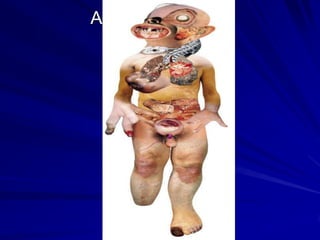 ADOLESCENCIA
 TABAQUISMO
 