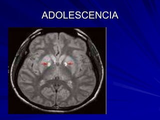 ADOLESCENCIA
 