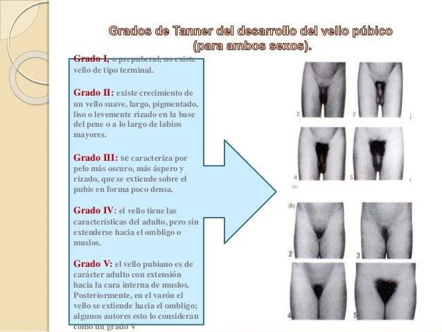 El modo rápido el aumento del miembro