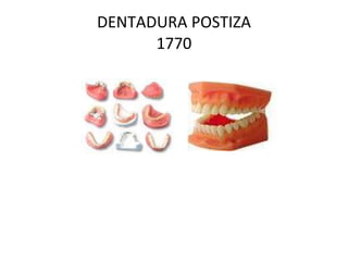 DENTADURA POSTIZA 1770 