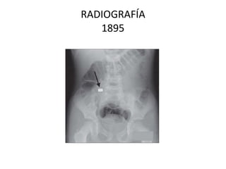 RADIOGRAFÍA 1895 