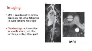 Imaging
• MRI is an alternative option
especially for serial follow up
to avoid ionizing radiation
• Disadvantage: not sensitive
for calcifications, not ideal
for stainless steel stent graft
MRI
 