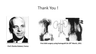 Thank You !
Prof. Charles Dubost, France
First AAA surgery using homograft On 29th March, 1951
 
