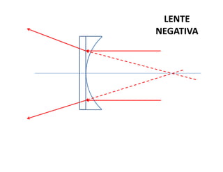 LENTE
NEGATIVA
 