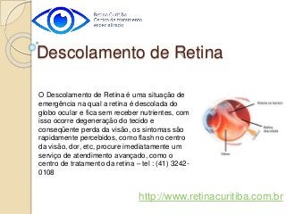 O Descolamento de Retina é uma situação de
emergência na qual a retina é descolada do
globo ocular e fica sem receber nutrientes, com
isso ocorre degeneração do tecido e
conseqüente perda da visão, os sintomas são
rapidamente percebidos, como flash no centro
da visão, dor, etc, procure imediatamente um
serviço de atendimento avançado, como o
centro de tratamento da retina – tel : (41) 3242-
0108
Descolamento de Retina
http://www.retinacuritiba.com.br
 