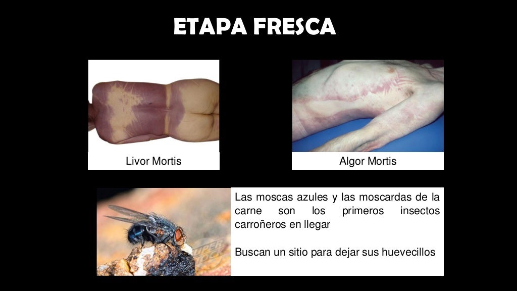 cadaverica