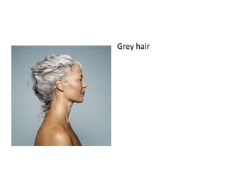 Grey hair
 