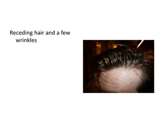 Receding hair and a few
wrinkles
 