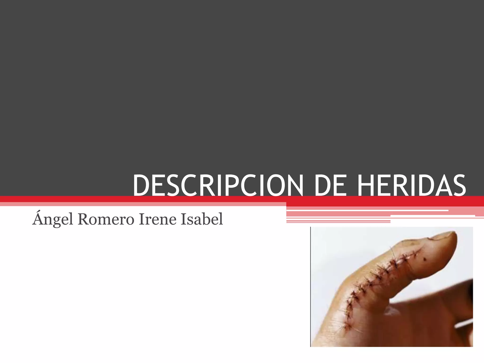 DESCRIPCION DE HERIDASÁngel Romero Irene Isabel