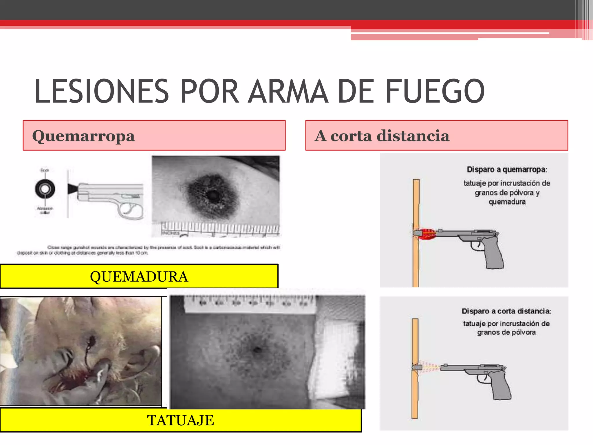 LESIONES POR ARMA DE FUEGOQuemarropaA corta distanciaQUEMADURATATUAJE