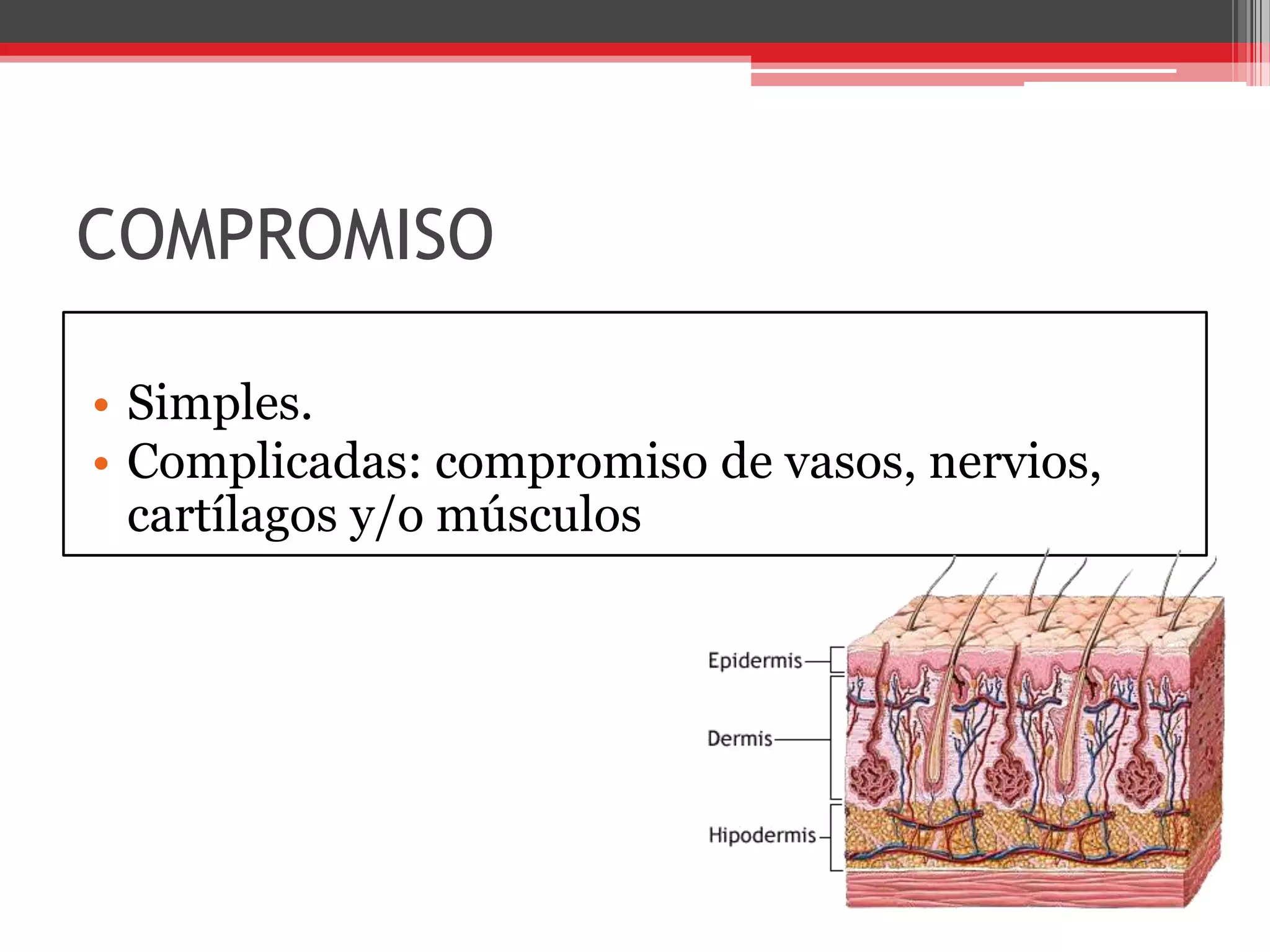 COMPROMISOSimples. Complicadas: compromiso de vasos, nervios, cartílagos y/o músculos 
