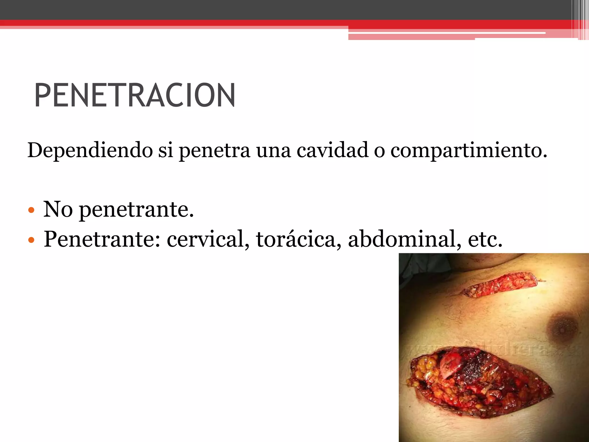 PENETRACIONDependiendo si penetra una cavidad o compartimiento.No penetrante. Penetrante: cervical, torácica, abdominal, etc. 