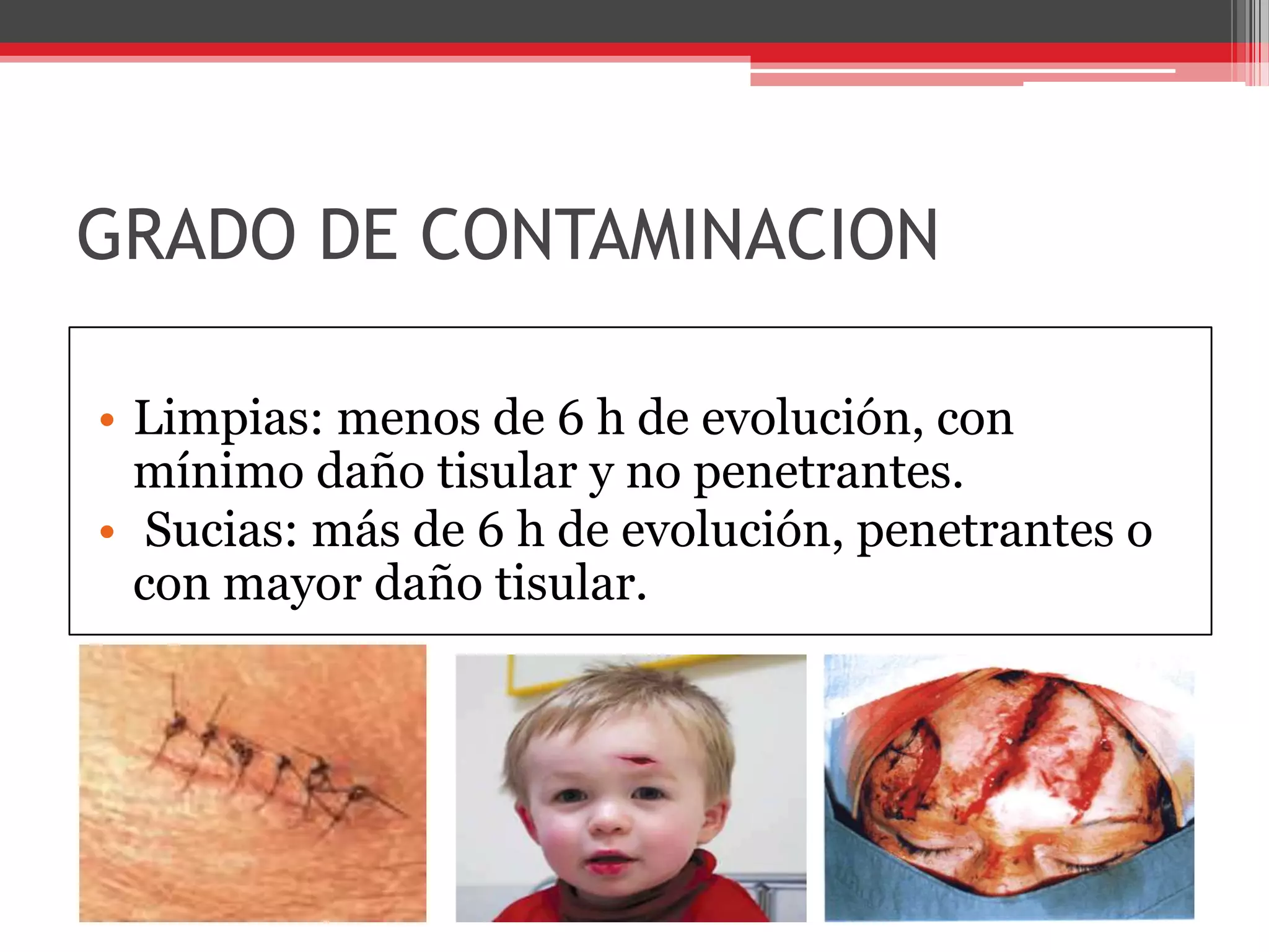 GRADO DE CONTAMINACION Limpias: menos de 6 h de evolución, con mínimo daño tisular y no penetrantes. Sucias: más de 6 h de evolución, penetrantes o con mayor daño tisular. 