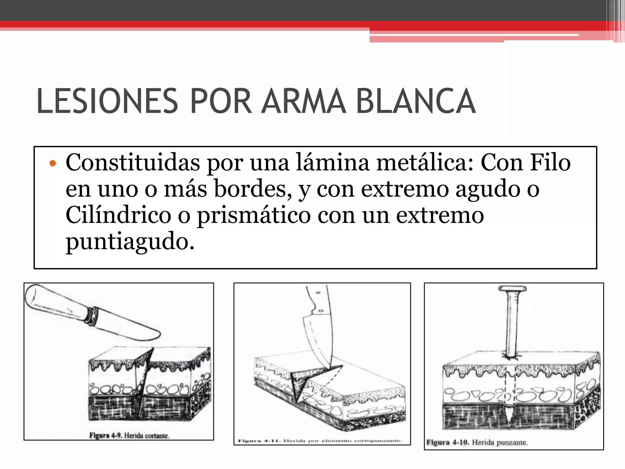 LESIONES POR ARMA BLANCAConstituidas por una lámina metálica: Con Filo en uno o más bordes, y con extremo agudo o Cilíndrico o prismático con un extremo puntiagudo. 