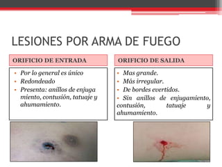 LESIONES POR ARMA DE FUEGOORIFICIO DE ENTRADAORIFICIO DE SALIDAPor lo general es únicoRedondeadoPresenta: anillos de enjuga miento, contusión, tatuaje y ahumamiento.Mas grande.Más irregular.De bordes evertidos.Sin anillos de enjugamiento, contusión, tatuaje y ahumamiento.