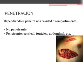 PENETRACIONDependiendo si penetra una cavidad o compartimiento.No penetrante. Penetrante: cervical, torácica, abdominal, etc. 