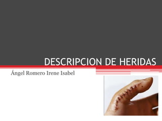 DESCRIPCION DE HERIDAS Ángel Romero Irene Isabel 
