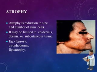 Description of basic skin lesions | PPTX