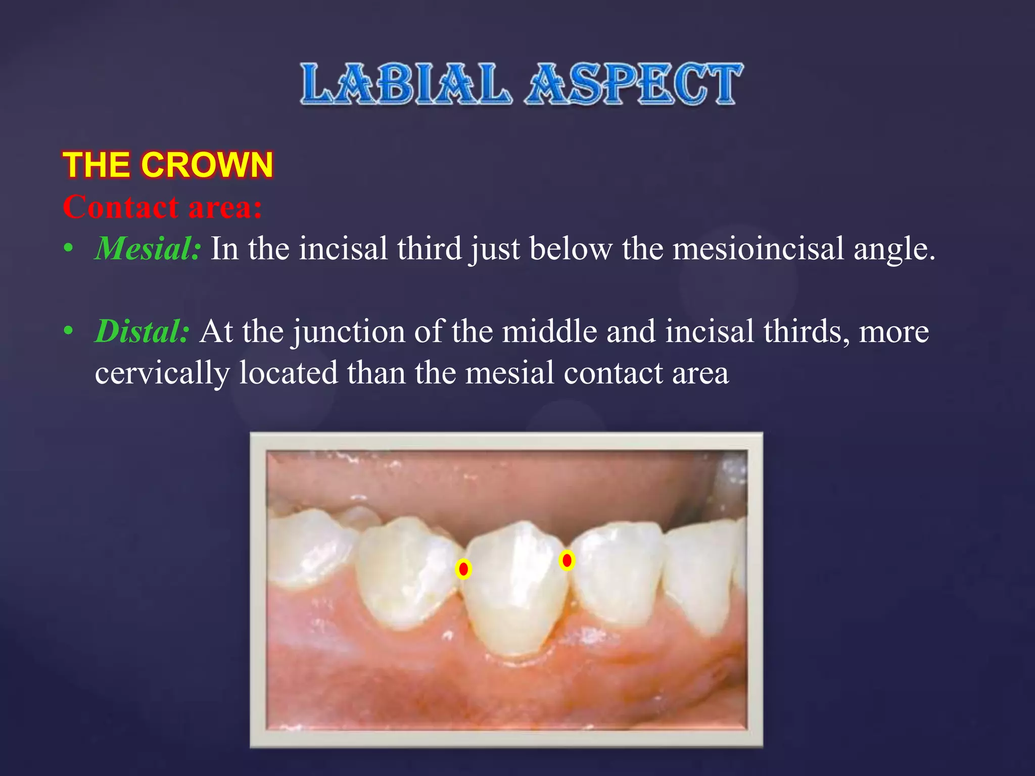 THE CROWN
Contact area:
• Mesial: In the incisal third just below the mesioincisal angle.

• Distal: At the junction of the middle and incisal thirds, more
  cervically located than the mesial contact area
 