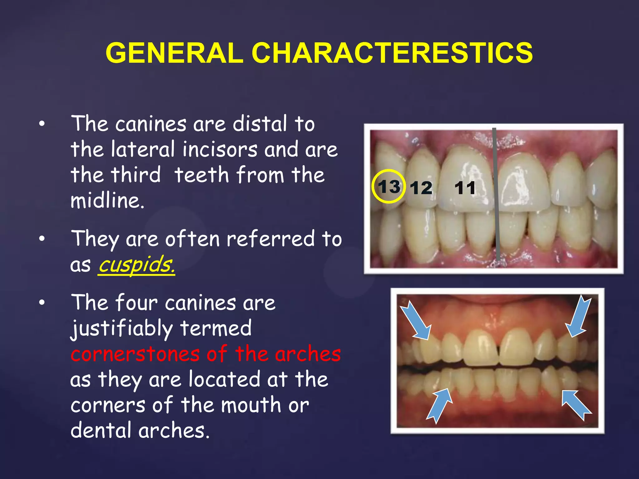 GENERAL CHARACTERESTICS

•   The canines are distal to
    the lateral incisors and are
    the third teeth from the
                                   13 12   11
    midline.
•   They are often referred to
    as cuspids.
•   The four canines are
    justifiably termed
    cornerstones of the arches
    as they are located at the
    corners of the mouth or
    dental arches.
 