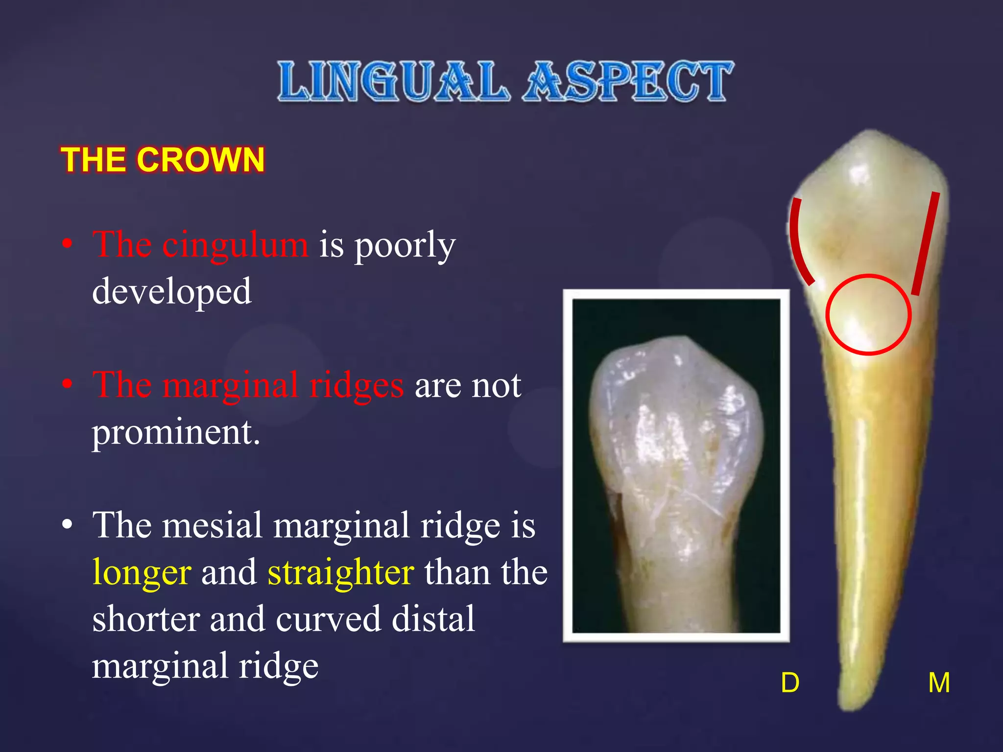 THE CROWN

• The cingulum is poorly
  developed

• The marginal ridges are not
  prominent.

• The mesial marginal ridge is
  longer and straighter than the
  shorter and curved distal
  marginal ridge                   D   M
 