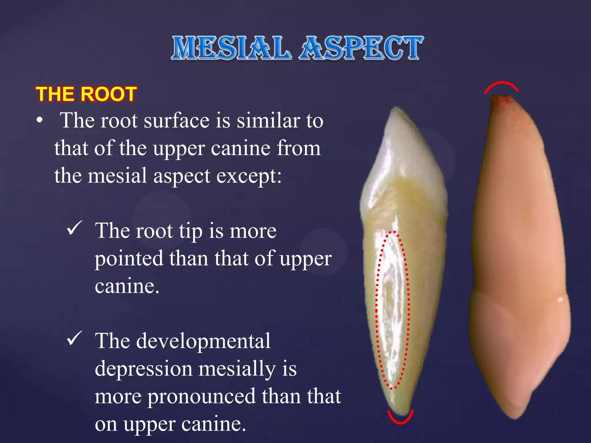 THE ROOT
• The root surface is similar to
  that of the upper canine from
  the mesial aspect except:

    The root tip is more
     pointed than that of upper
     canine.

    The developmental
     depression mesially is
     more pronounced than that
     on upper canine.
 