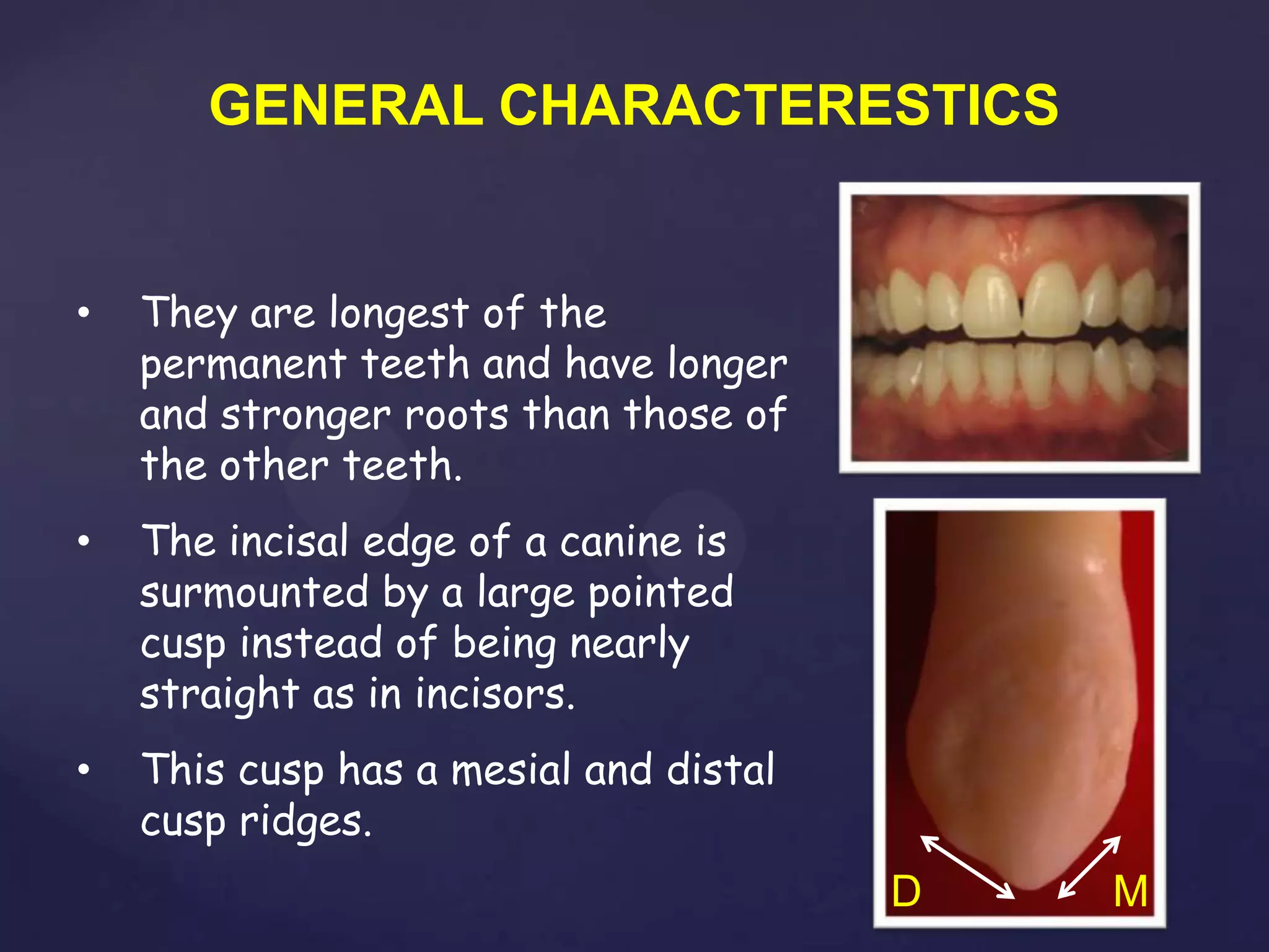 GENERAL CHARACTERESTICS


•   They are longest of the
    permanent teeth and have longer
    and stronger roots than those of
    the other teeth.
•   The incisal edge of a canine is
    surmounted by a large pointed
    cusp instead of being nearly
    straight as in incisors.
•   This cusp has a mesial and distal
    cusp ridges.
                                        D   M
 