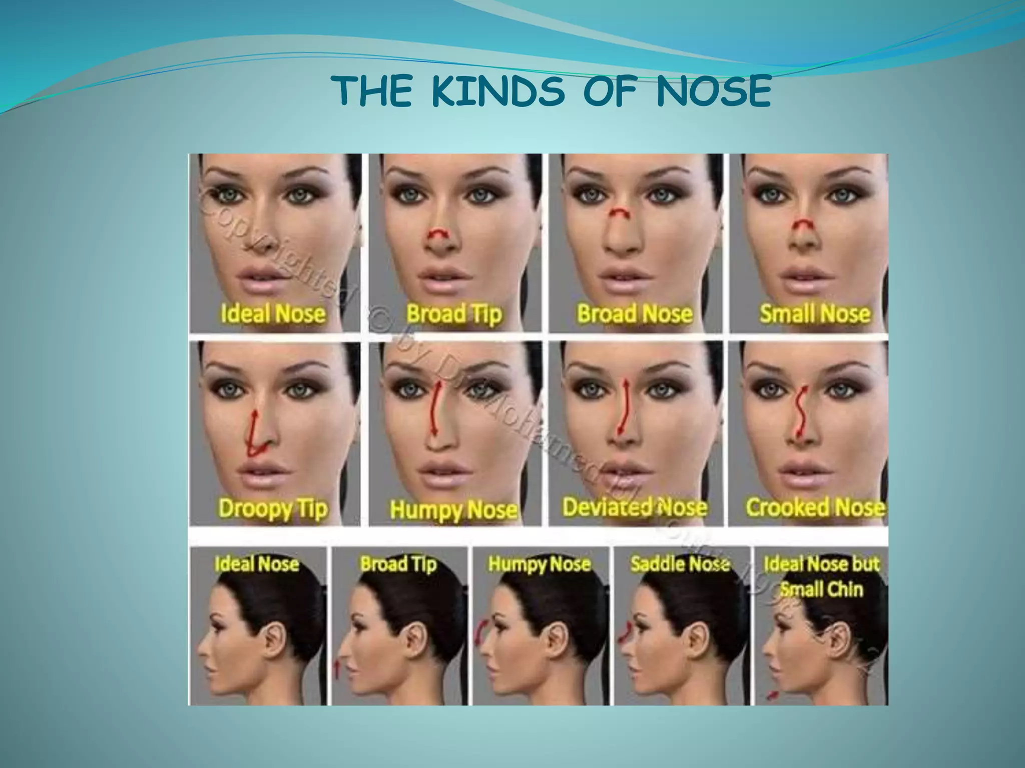 THE KINDS OF NOSE
 