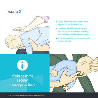 O QUE FAZER QUANDO SEU BEBÊ ENGASGAR?
	 Com o dedo indicador e médio deve
segurar a boca do bebê aberta.
	 Coloque o bebê deitado de barriga
para baixo em cima do seu antebraço,
com a cabeça mais baixa que o corpo.
	 Apoie seu antebraço na sua coxa para
ter mais firmeza.
Visão de como
segurar
a cabeça do bebê
PASSO 2
 