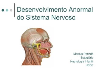 Desenvolvimento Anormal 
do Sistema Nervoso 
Marcus Petindá 
Estagiário 
Neurologia Infantil 
HBDF 
 