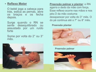  Reflexo Motor
O bebê joga a cabeça para
trás, estica as pernas, abre
os braços e os fecha
depois.
Surge quando o RN se
sente desequilibrado ou
assustado por um ruído
forte
Some por volta do 2° ou 3°
mês.
Preensão palmar e plantar: o RN
agarra o dedo da mãe com força.
Esse reflexo ocorre nas mãos e nos
pés.O da mão costuma
desaparecer por volta do 3° mês. O
do pé continua até o 7° ou 8° mês.
Preensão plantar
Preensão palmar
 