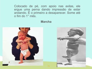 Colocado de pé, com apoio nas axilas, ele
ergue uma perna dando impressão de estar
andando. É o primeiro a desaparecer. Some até
o fim do 1° mês.
Marcha
 