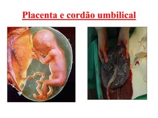 Placenta e cordão umbilical
 
