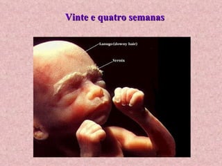 Vinte e quatro semanas 