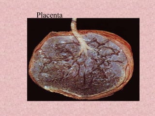 Placenta 